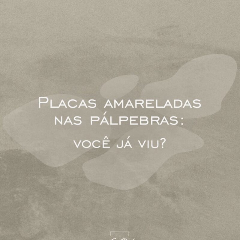 o-que-e-xantelasma-dra-carolina-angeloni-especialista-em-blefaroplastia-mato-grosso-cuiaba