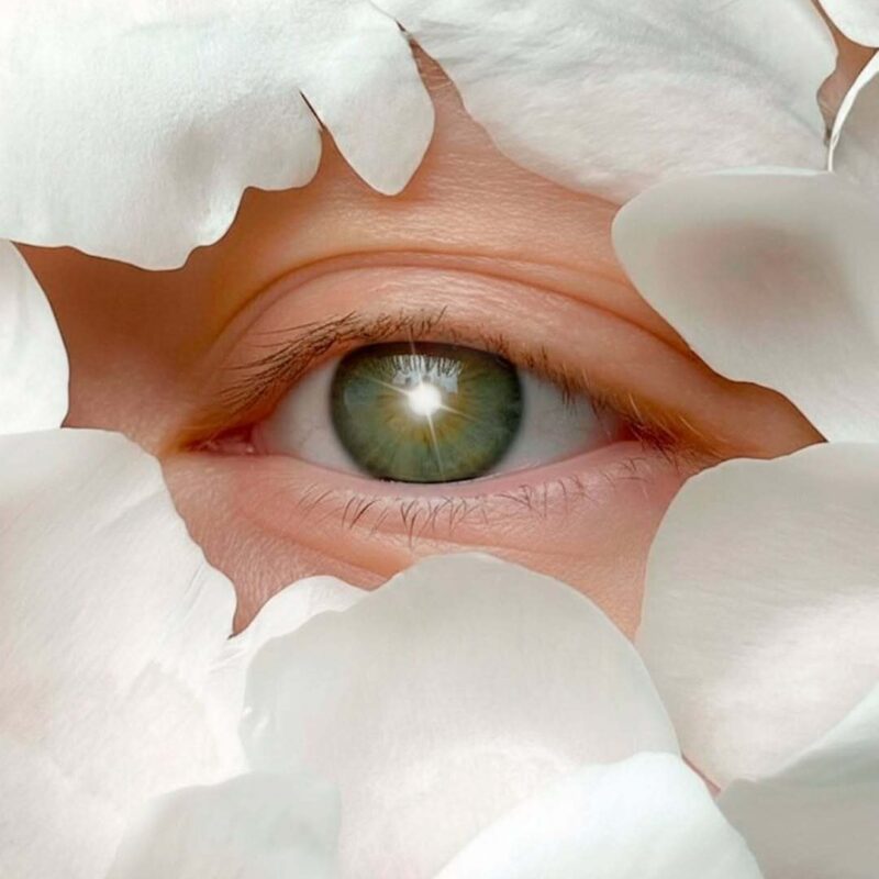 dra-carolina-angeloni-especialista-em-blefaroplastia-em-cuiaba-mato-grosso