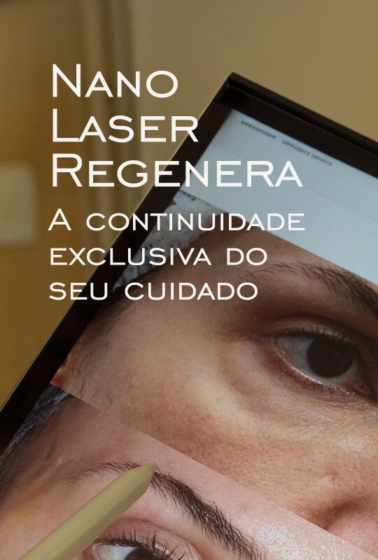 laser-regenera-na-blefaroplastia-dra-carolina-angeloni-especialista-em-blefaroplastia-cuiaba-mato-grosso