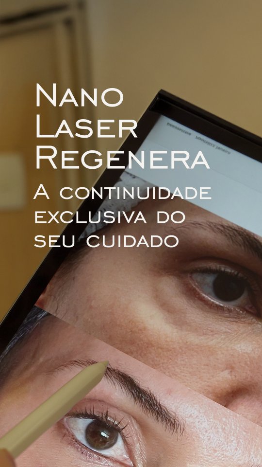 laser-regenera-na-blefaroplastia-dra-carolina-angeloni-especialista-em-blefaroplastia-cuiaba-mato-grosso