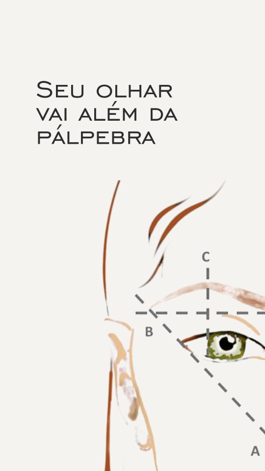 lifting-facial-dra-carolina-angeloni-blefaroplastia-cuiaba-mato-grosso