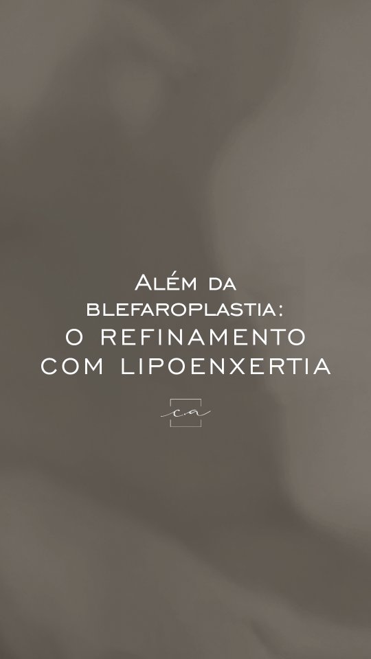 lipoenxertia-dra-carolina-angeloni-especialista-em-blefaroplastia-cuiaba-mato-grosso