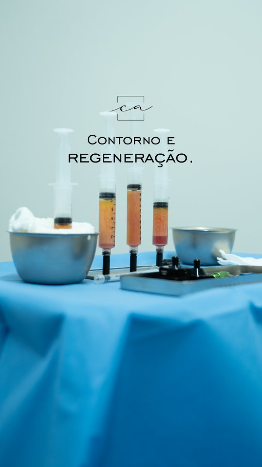 lipoenxertia-dra-carolina-angeloni-blefaroplastia-cuiaba-mato-grosso