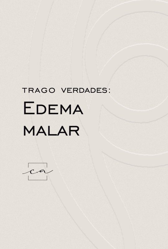 tratamento-edema-malar-festoon-oculoplastica-cuiaba-mt